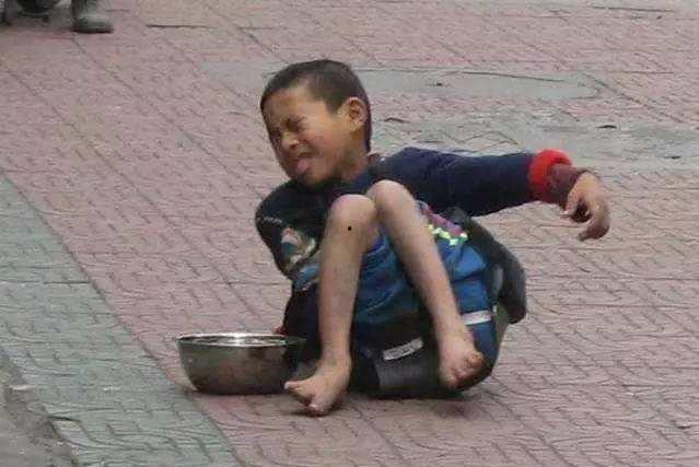 小乞丐吃瓜视频